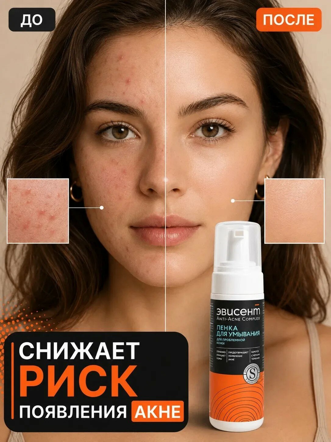 Пенка для умывания Эвисент Anti-Acne Complex для проблемной кожи, без спирта, 160 мл